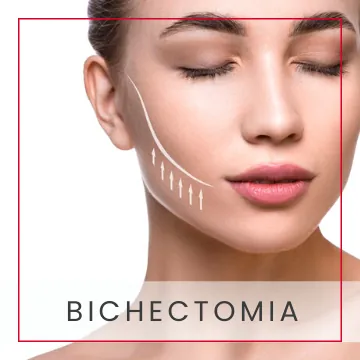 Bichectomía