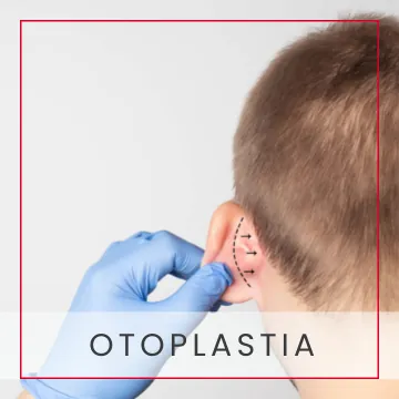 Otoplastia