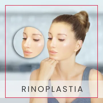 Rinoplastia / Rinoseptoplastia