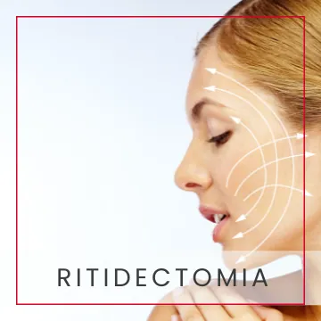 Ritidectomía (lifting facial)