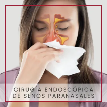 Cirugía de senos paranasales
